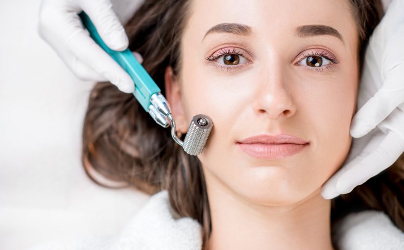 microneedling