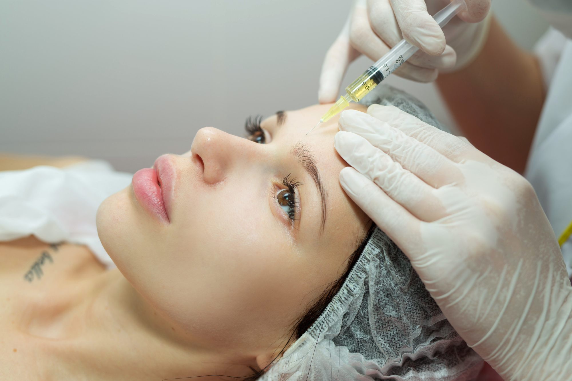 Baby Botox: A Guide to The Newest Botox Everyone Wants - My Botox LA