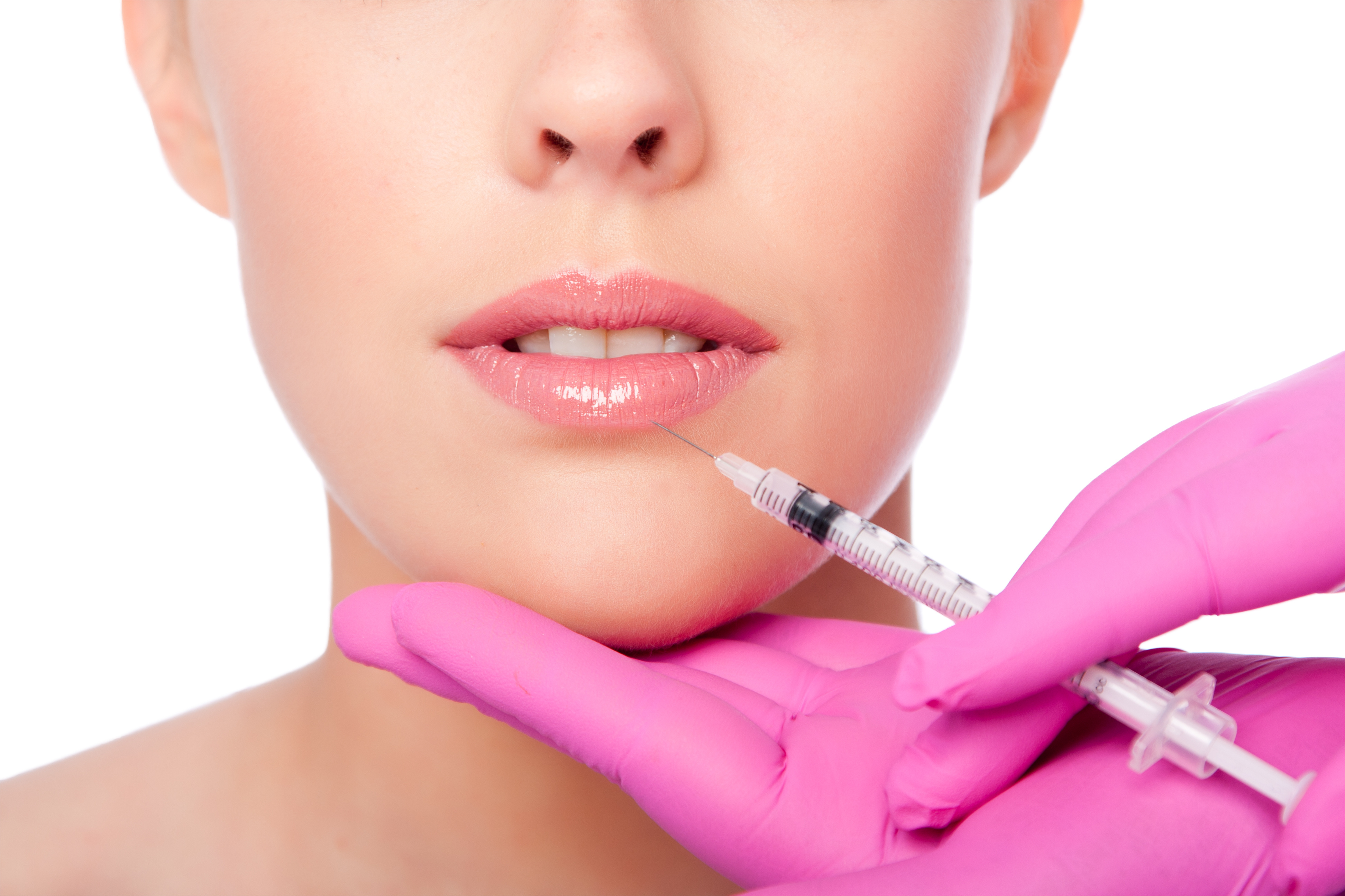 What to Expect From Your First Lip Filler Treatment - My Botox LA Med Spa  News & Articles
