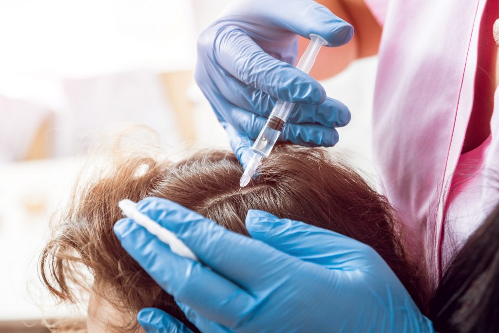 prp treatments for hair