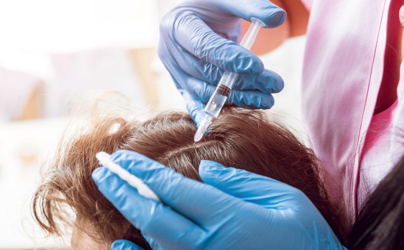 prp hair treatment