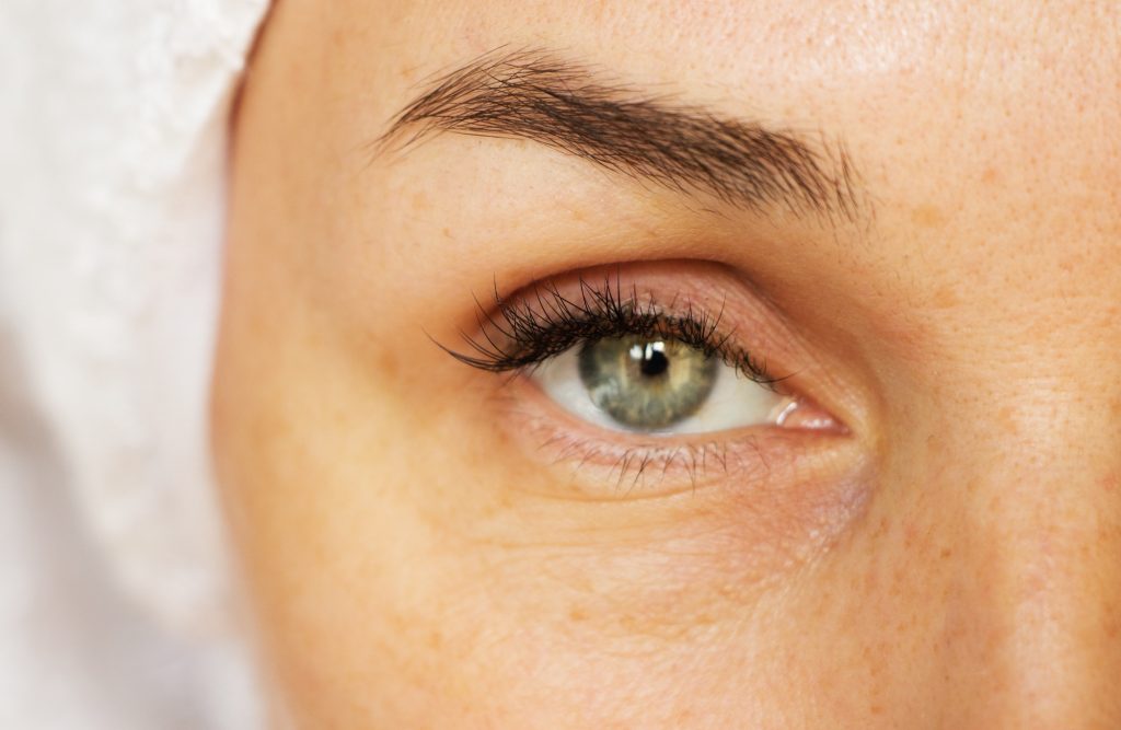 under eye fillers