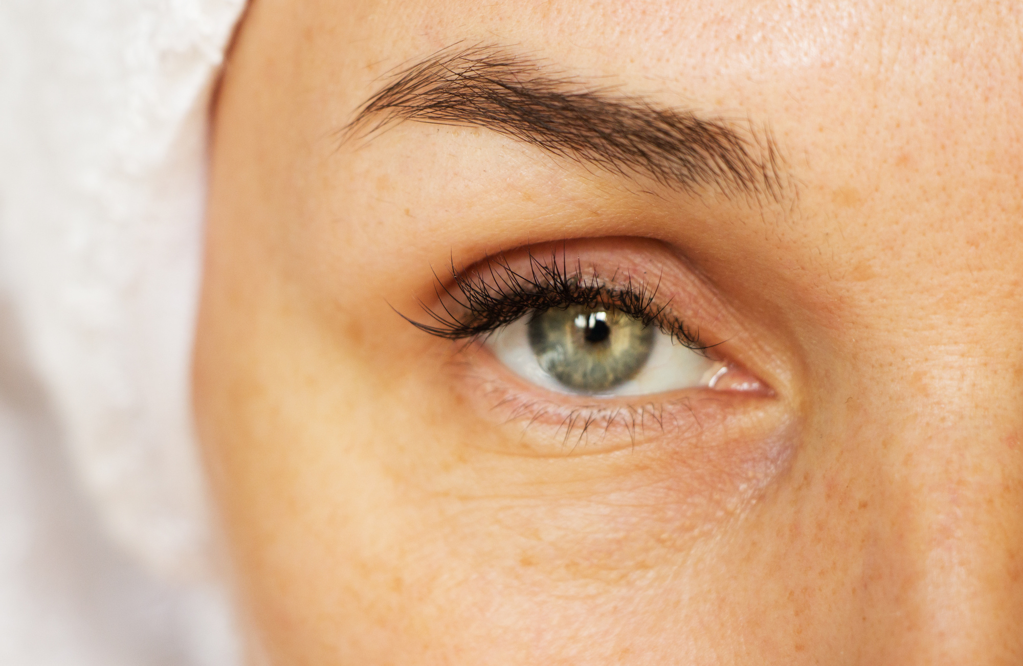 The Magical And Wrinkle Erasing Benefits Of Under Eye Fillers My