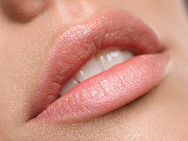 BEST TREATMENT FOR LIP LINES