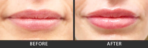 Before and After Photo