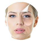 Belotero Injections