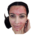Vampire Facial